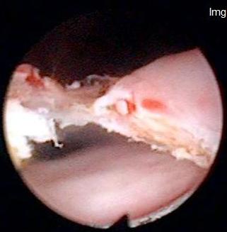 Ectopic ureter kimba0010 Ectopic ureter kimba0010